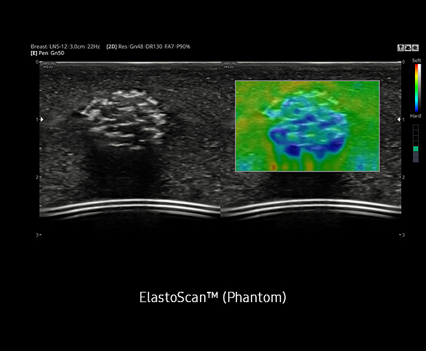 ecografo-samsung-hera-HS30-ElastoScan