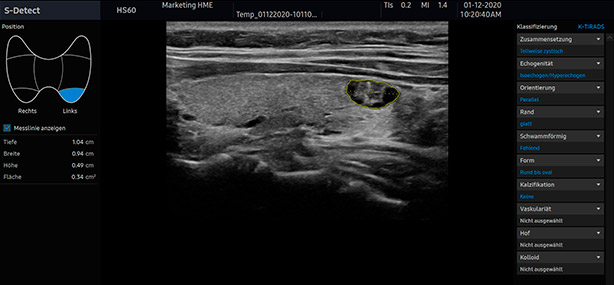 HS60-S-Detect-Tiroides