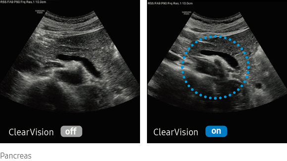 RS80-EVO-ClearVision