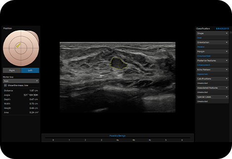 Samsung-V7_SDetectBreast