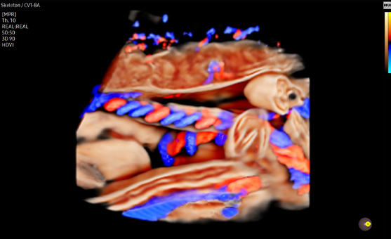 samsung_crystalive3D_Crystalvue_flow