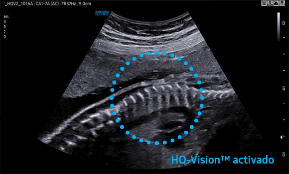 samsung_crystalive_HQVision